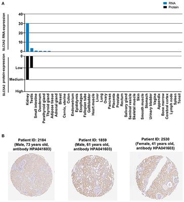 The Effect of Sodium Glucose Cotransporter 2 Inhibitors From a Human Genetic Perspective